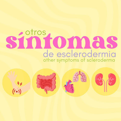 Otros síntomas de Esclerodermia